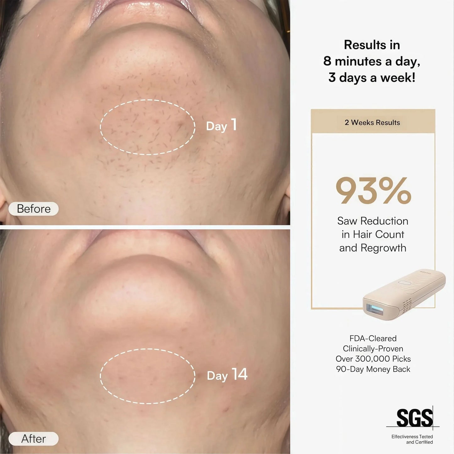 NAMI IPL Hair Removal Device