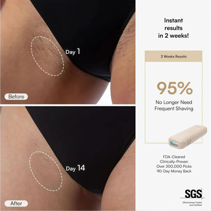 NAMI IPL Hair Removal  Device