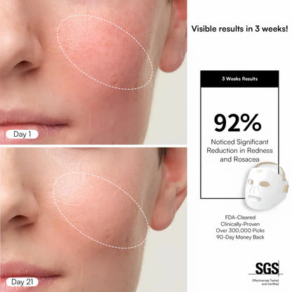 LUMI LED Light Therapy Facial Mask