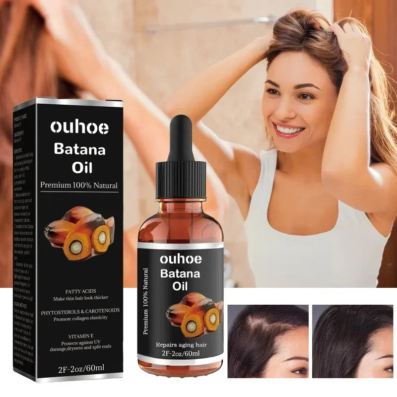 OuhoeHair™ Batana Oil Oil for Healthy Hair 100% Natural Promotes Hair Wellness for Men & Women Enhances Hair