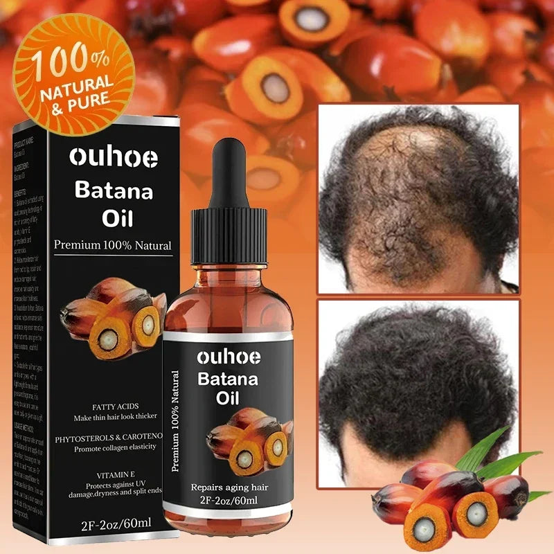 OuhoeHair™ Batana Oil Oil for Healthy Hair 100% Natural Promotes Hair Wellness for Men & Women Enhances Hair