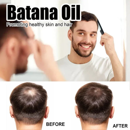 OuhoeHair™ Batana Oil Oil for Healthy Hair 100% Natural Promotes Hair Wellness for Men & Women Enhances Hair