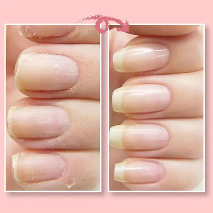 Nail Repair Protection Gel